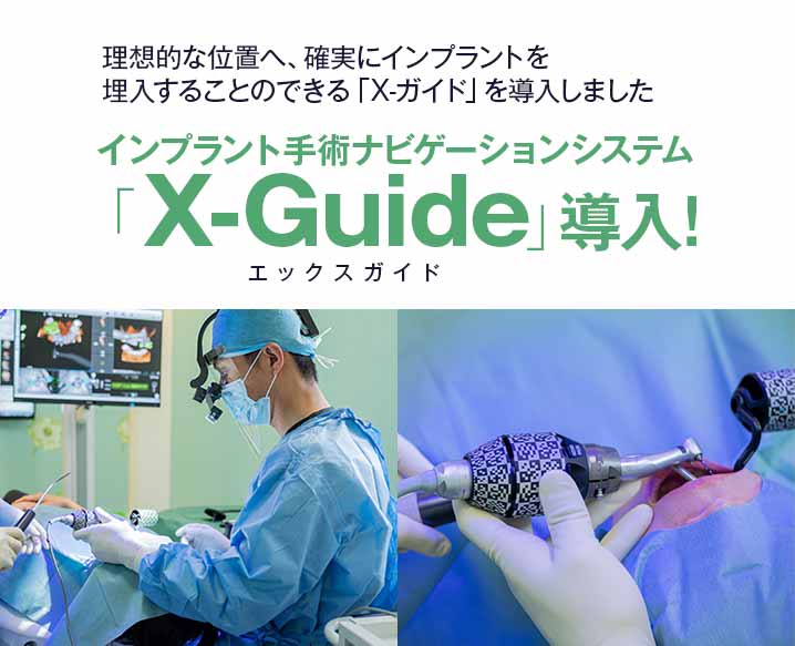 インプラント手術ナビゲーションシステム 「X-Guide」導入!